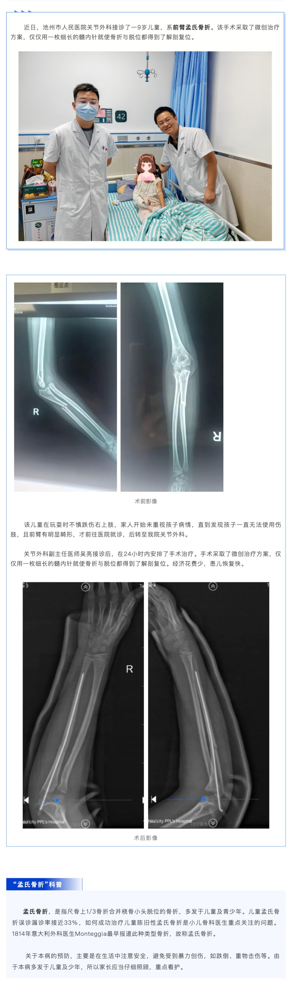 警惕！極易漏診的兒童骨折：孟氏骨折_壹伴長(zhǎng)圖1.jpg